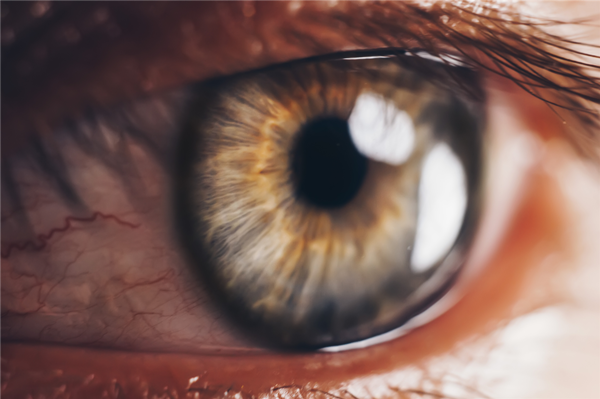 青光眼,希瑪瑞視眼科,上海眼科醫(yī)院