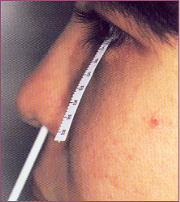 眼表眼角膜,希瑪瑞視眼科,上海眼科醫(yī)院