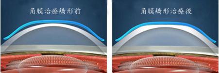 醫(yī)學(xué)驗(yàn)光配鏡,?，斎鹨曆劭?上海眼科醫(yī)院