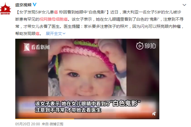 眼眶病,?，斎鹨曆劭?上海眼科醫(yī)院