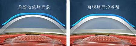 小兒眼病,?，斎鹨曆劭?上海眼科醫(yī)院