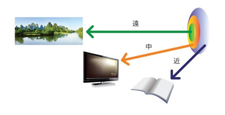 白內(nèi)障,?，斎鹨曆劭?上海眼科醫(yī)院