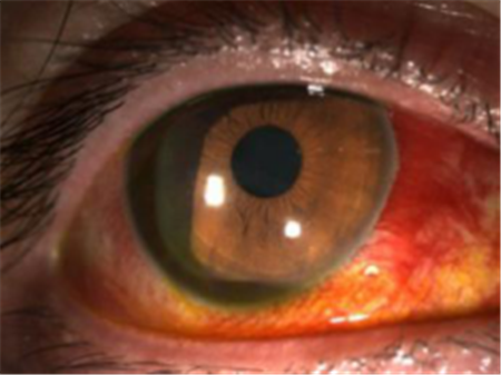 玻璃體視網(wǎng)膜,?，斎鹨曆劭?上海眼科醫(yī)院