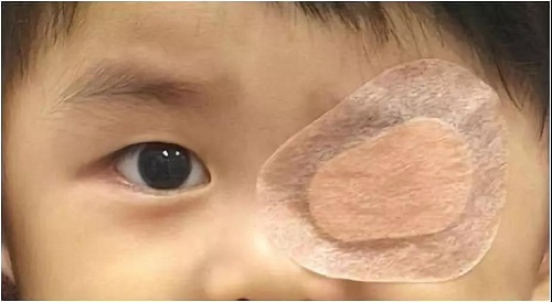 小兒眼病,?，斎鹨曆劭?上海眼科醫(yī)院