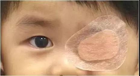 小兒眼病,?，斎鹨曆劭?上海眼科醫(yī)院