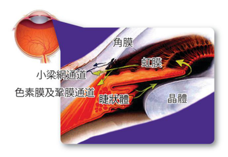 青光眼,?，斎鹨曆劭?上海眼科醫(yī)院