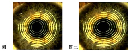 小兒眼病,?，斎鹨曆劭?上海眼科醫(yī)院