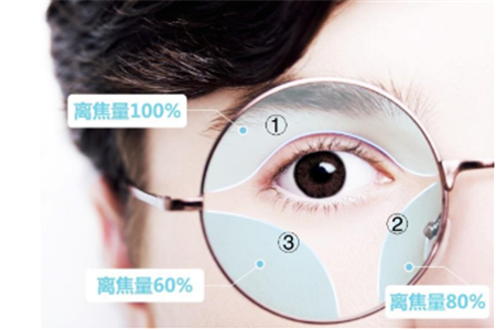 小兒眼病,希瑪瑞視眼科,上海眼科醫(yī)院