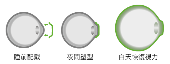 小兒眼病,?，斎鹨曆劭?上海眼科醫(yī)院