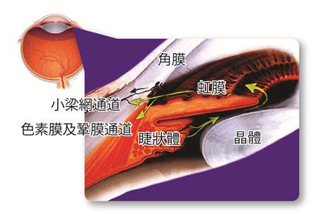 青光眼,希瑪瑞視眼科,上海眼科醫(yī)院