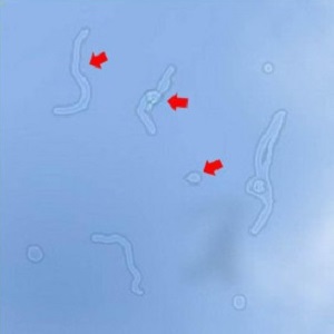 玻璃體視網(wǎng)膜,希瑪瑞視眼科,上海眼科醫(yī)院