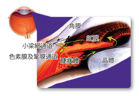 青光眼,希瑪瑞視眼科,上海眼科醫(yī)院