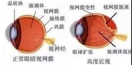 玻璃體視網(wǎng)膜,希瑪瑞視眼科,上海眼科醫(yī)院