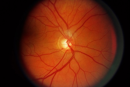 眼表眼角膜,?，斎鹨曆劭?上海眼科醫(yī)院