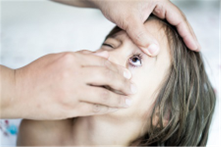 眼表眼角膜,?，斎鹨曆劭?上海眼科醫(yī)院