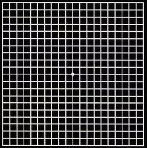 玻璃體視網(wǎng)膜,?，斎鹨曆劭?上海眼科醫(yī)院