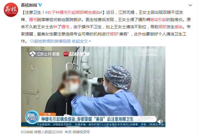 眼表眼角膜,?，斎鹨曆劭?上海眼科醫(yī)院