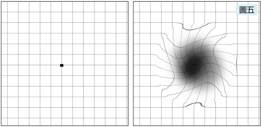 玻璃體視網(wǎng)膜,?，斎鹨曆劭?上海眼科醫(yī)院