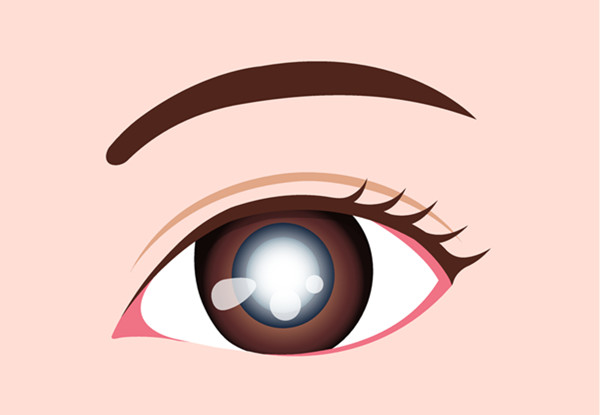 小兒眼病,?，斎鹨曆劭?上海眼科醫(yī)院