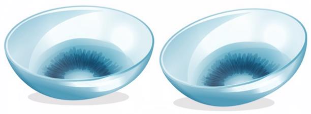 醫(yī)學(xué)驗(yàn)光配鏡,?，斎鹨曆劭?上海眼科醫(yī)院