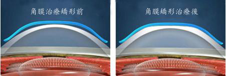 醫(yī)學(xué)驗(yàn)光配鏡,希瑪瑞視眼科,上海眼科醫(yī)院